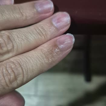 Protez Tırnak Sonrası Ağrılı Etler Ve Yanıtsız İletişim İade Talebi