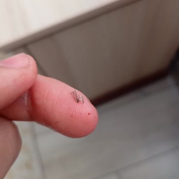 Kazandibi İçinde Yanmış Plastik Parça Bulunması