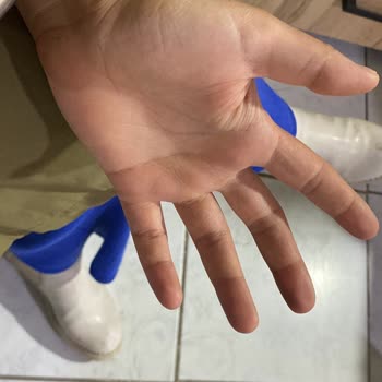Alerjik Reaksiyon Ve Sivilcelenme Sonrası Kaba Müşteri Hizmetleri İade Talebi