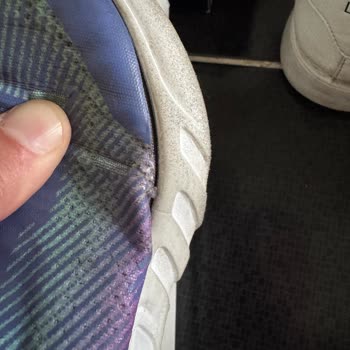 Skechers Kısa Sürede Açılan Çocuk Ayakkabısına Kullanıcı Hatası İddiası