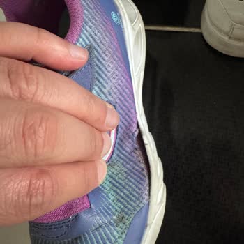 Skechers Kısa Sürede Açılan Çocuk Ayakkabısına Kullanıcı Hatası İddiası