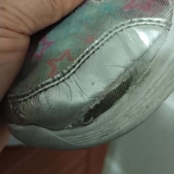 Skechers Kısa Sürede Açılan Çocuk Ayakkabısına Kullanıcı Hatası İddiası