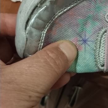 Skechers Kısa Sürede Açılan Çocuk Ayakkabısına Kullanıcı Hatası İddiası