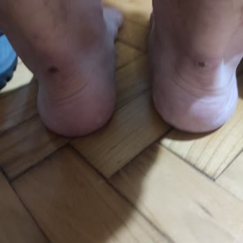 Ayakkabım 15 Dakikada Ayağımı Yaraladı Ve Mağaza İadeyi Reddetti