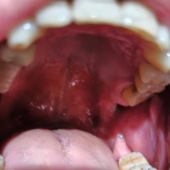 Colgate Üçlü Etki Nane Ferahlığı Diş Macunu Aşındırıcı Etkisi Diş Mine Aşınmasına Neden Oluyor