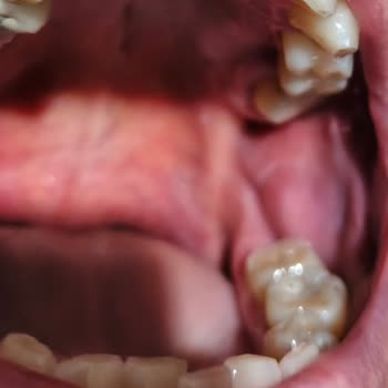 Colgate Üçlü Etki Nane Ferahlığı Diş Macunu Aşındırıcı Etkisi Diş Mine Aşınmasına Neden Oluyor