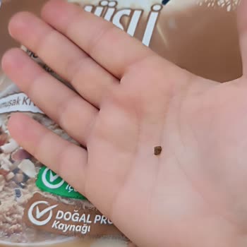 Müsli İçinde Taş Bulunması Dişime Neredeyse Kırılmaya Neden Oldu