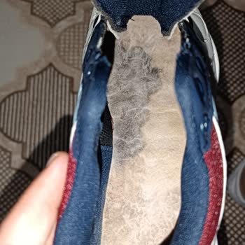 Küflü Ve Kötü Kokulu Ayakkabının İadesi Talebi