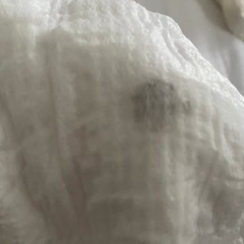 Molfix 2 Numaralı Bebek Bezinde Siyah Yabancı Cisim Güven Sorunu