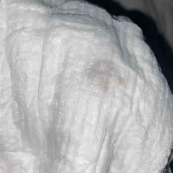 Molfix 2 Numaralı Bebek Bezinde Siyah Yabancı Cisim Güven Sorunu