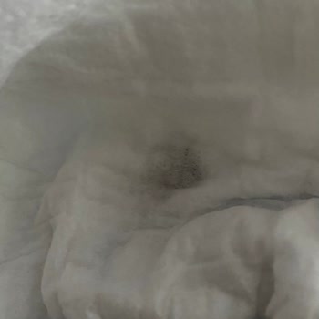 Molfix 2 Numaralı Bebek Bezinde Siyah Yabancı Cisim Güven Sorunu