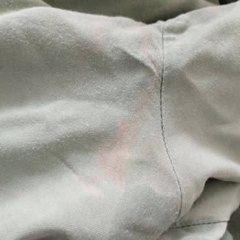 Tereson Sprey Ürünün Kumaşa Zarar Vermesi Ve Sağlık Etkileri Hakkında Açıklama Talebi