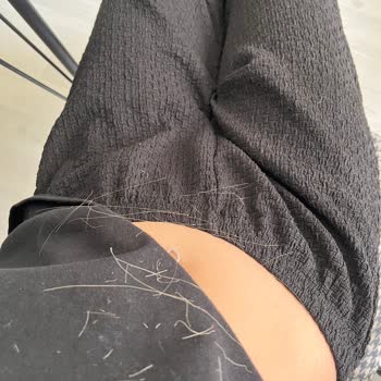 Saçlarım Sapsarı Renge Dönüştü Ve Ağır Şekilde Yıprandı