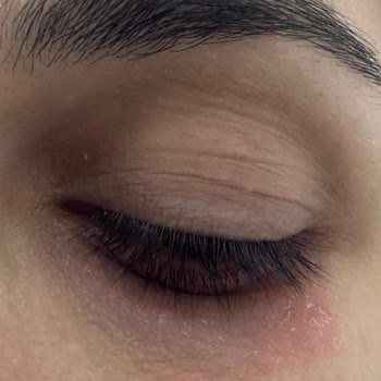 Bioderma Atoderm Göz Kremi Yanma Ve Egzama Yaratırken, Trendyol İade Sürecini Reddetti