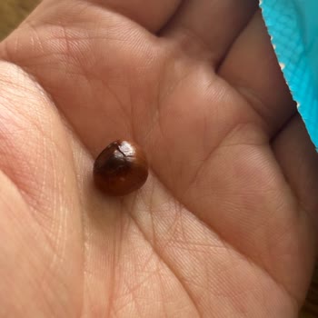 Kabuklu Fındık Çikolatalı Drajede Diş Ağrısı Ve Sağlık Riski