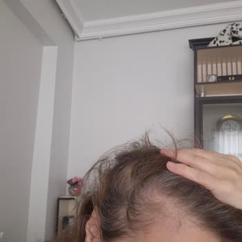 Geçmiş Üretim Tarihli Şampuan Satışı Ve İade Reddi
