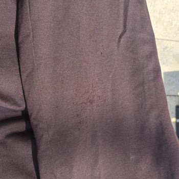Calzedonia Pantolonunda Tüylenme Ve İade Reddi