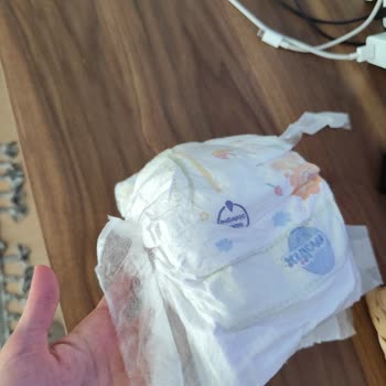 Bozuk Molfix Bebek Bezleri İçin Değişim Ve Üretim İncelemesi Talebi
