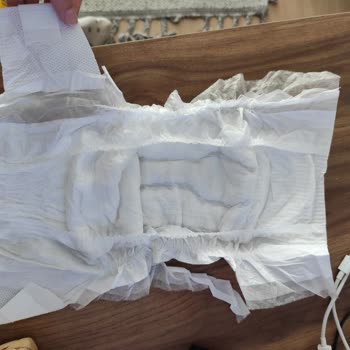 Bozuk Molfix Bebek Bezleri İçin Değişim Ve Üretim İncelemesi Talebi