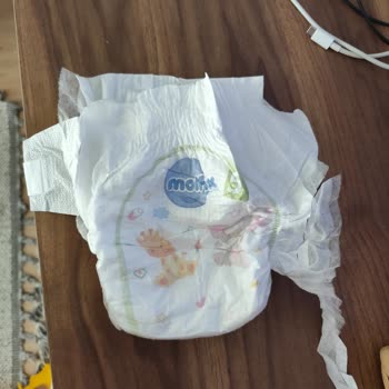 Bozuk Molfix Bebek Bezleri İçin Değişim Ve Üretim İncelemesi Talebi