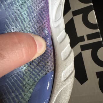 Skechers Ayakkabısında Erken Yıpranma Ve Mağaza Reddine Karşı Ücret İadesi Talebi