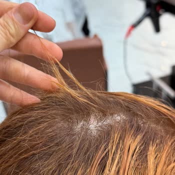 Mossi Kuaför'de Renk Hatası Ve Kırık Saçlar Nedeniyle Müşteri İhmaline Karşı Şikayet