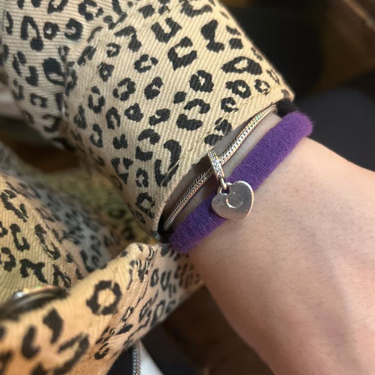 Pandora Charm’da Hızlı Oksitlenme Ve Personelin İlgisiz Yaklaşımı