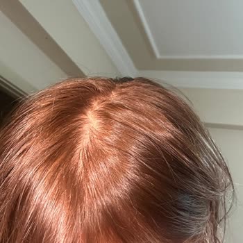 Schwarzkopf Küllü Soğuk Sarı Boya Rengi Yanlış, Saç Derisinde Yanma Ve Tahriş
