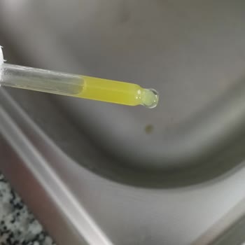 Nurse Harvey’s Kapalı Kutu İçindeki Bozulmuş Gaz Damlaları Çocuk Sağlığını Tehlikeye Atıyor