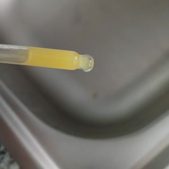 Nurse Harvey’s Kapalı Kutu İçindeki Bozulmuş Gaz Damlaları Çocuk Sağlığını Tehlikeye Atıyor