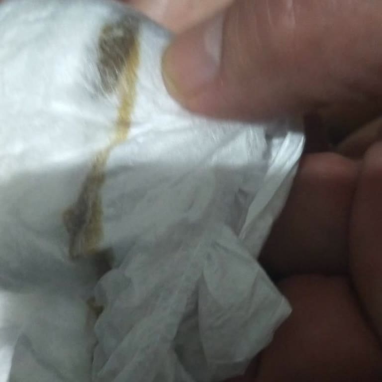 Molfix Bebek Bezinde Kaka Benzeri Madde, Hijyen Endişesi