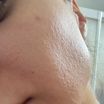 Cildimde Şiddetli Reaksiyon Ve Rossmann Mağazasının İade Reddi