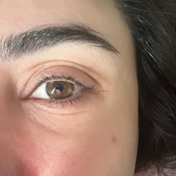 Cildimde Şiddetli Reaksiyon Ve Rossmann Mağazasının İade Reddi