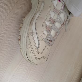 Skechers Ayakkabısında Erken Deformasyon Ve Kalite Şikayeti