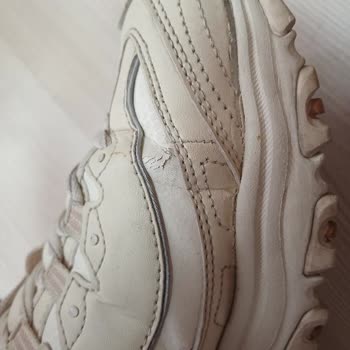 Skechers Ayakkabısında Erken Deformasyon Ve Kalite Şikayeti