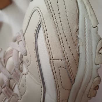 Skechers Ayakkabısında Erken Deformasyon Ve Kalite Şikayeti