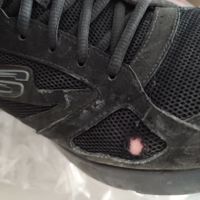 Skechers Ayakkabısının File Bölümündeki Erken Yırtılma Ve Garanti Reddi