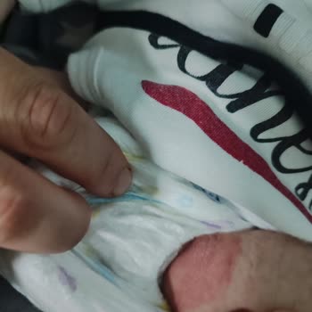 Molfix 1 Numaralı Bezlerde Aşırı Sızdırma Ve Şiddetli Pişik
