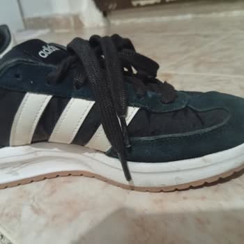 Adidas Bayan Ayakkabısının Kısa Sürede Renk Atması Ve Koku Sorunu