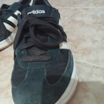 Adidas Bayan Ayakkabısının Kısa Sürede Renk Atması Ve Koku Sorunu