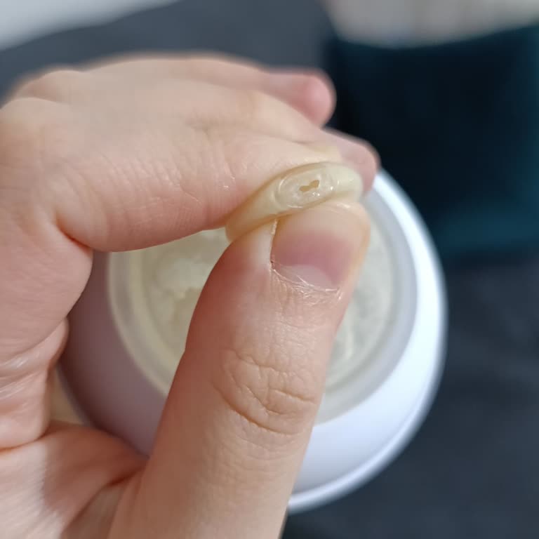 Philips Avent Emzik Uçunda Tekrarlayan Hızlı Akış Problemi
