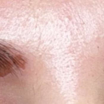Bee Beauty Saç Boyası Kullanımında Şiddetli Kaş Yanması Ve Deri Soyulması