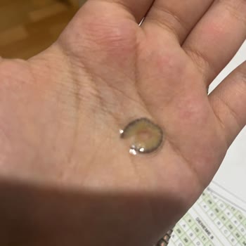 Yırtık Renkli Lens Ve Cevapsız İletişim Nedeniyle Ücretsiz Değişim İsteği