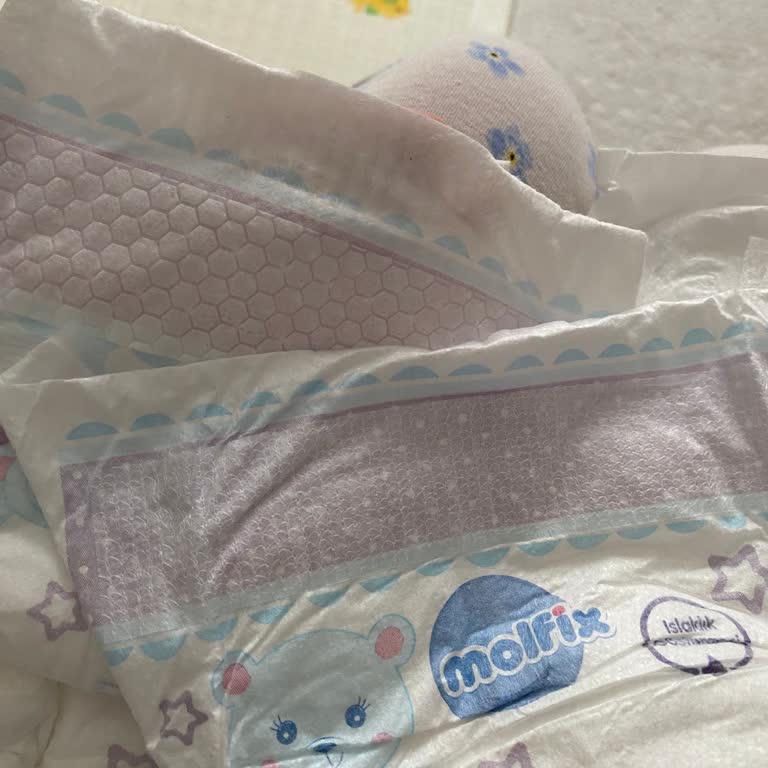 Molfix Bebek Bezlerinde Üst Kısmı Kısa Kesilmiş Üretim Hatası