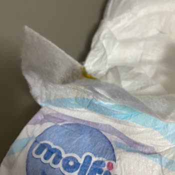 Molfix 5 Numaralı Bebek Bezlerinde Leke Ve Hijyen Endişesi