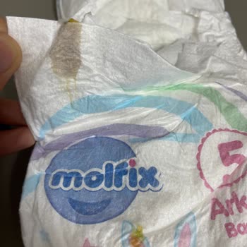 Molfix 5 Numaralı Bebek Bezlerinde Leke Ve Hijyen Endişesi