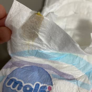Molfix 5 Numaralı Bebek Bezlerinde Leke Ve Hijyen Endişesi