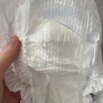 Molfix Klasik 3 Numaralı Bebek Bezinde Sert Silikon Parçaları Cilt Tahrişine Neden Olabilir