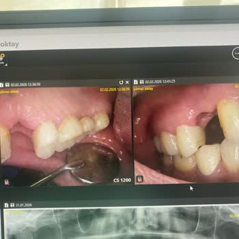 Dentius Klinik Hatalı Ve Eksik Tedaviler