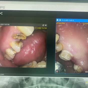 Dentius Klinik Hatalı Ve Eksik Tedaviler